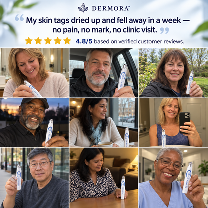 Dermora™ Skin Tag Removal