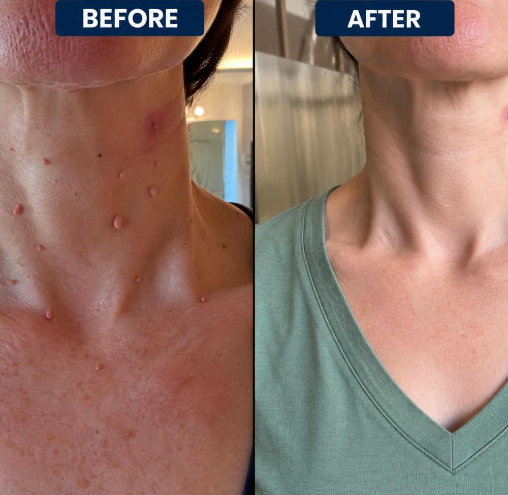 "Finally Feeling Confident in My Skin"