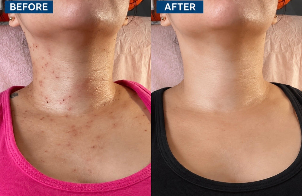 “I Finally Stopped Covering My Neck”