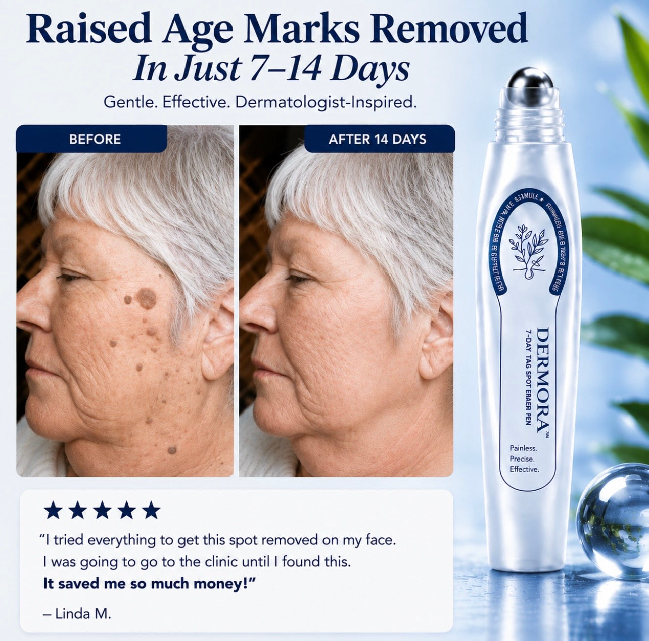 Dermora™ Skin Tag Removal