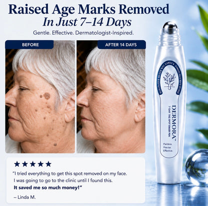 Dermora™ Skin Tag Removal